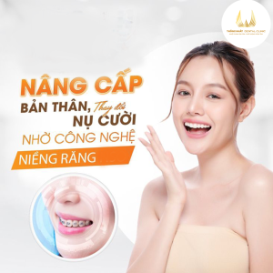 Địa Chỉ Niềng Răng Uy Tín Số 1 Vĩnh Phúc