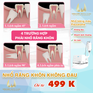 Địa Chỉ Nhổ Răng Khôn Số 1 Vĩnh Yên